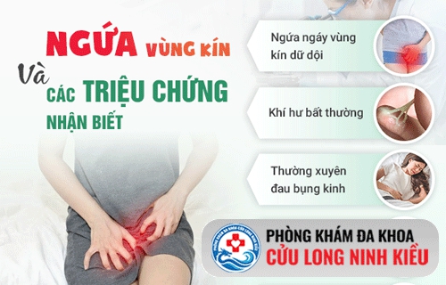Ngứa vùng kín sau khi quan hệ có sao không?