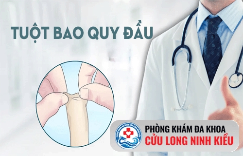 Tuột bao quy đầu