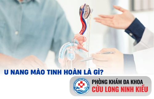 Bệnh u nang mào tinh hoàn và cách chữa trị