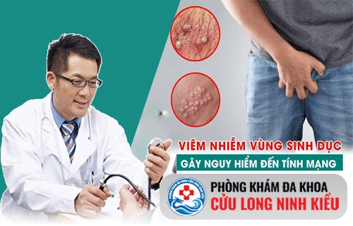 Viêm đường sinh dục nam là gì ?