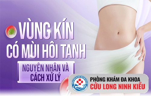 Giải quyết nỗi lo vùng kín có mùi hôi