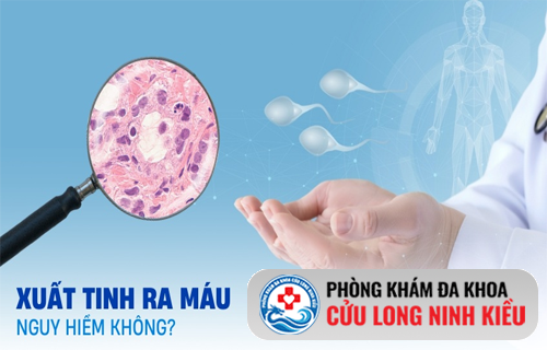 Xuất tinh ra máu nguy hiểm không? Chuyên gia cảnh báo điều gì?